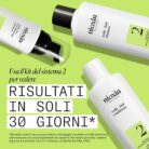Nioxin Sistema 2 Kit Trifasico Shampoo 300ml Conditioner 300ml Treatment 100ml- kit assottigliamento avanzato